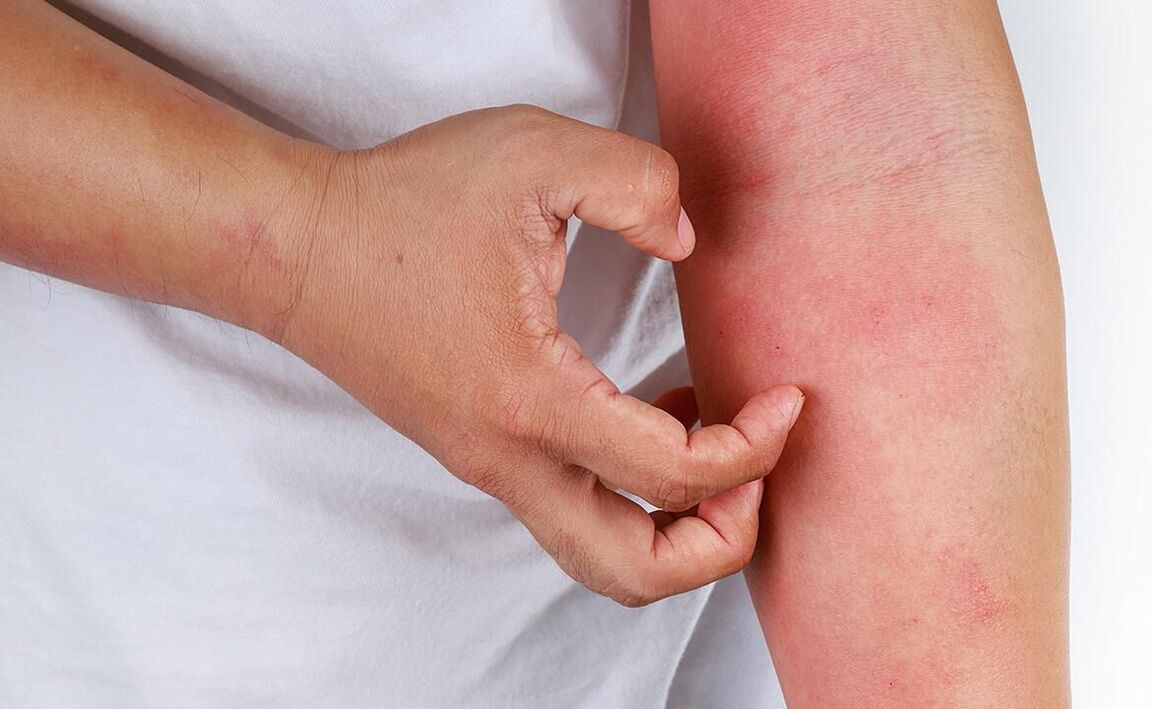 магчымыя ўскладненні ад выкарыстання соды